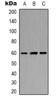POTEB3 / POTE-15 Antibody (C-Terminus)