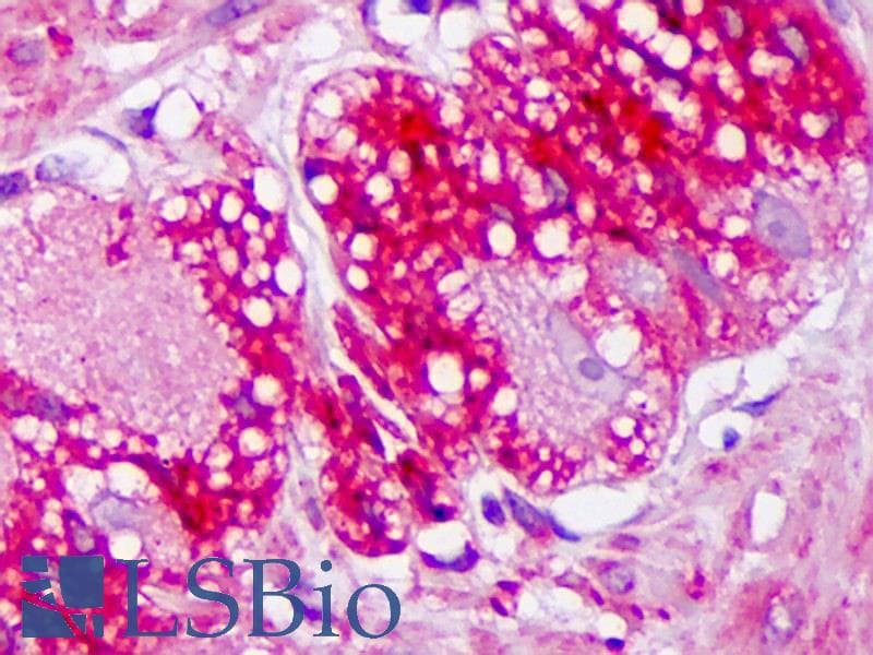 IHC-plus™ TRPV3 Antibody (aa458-474, clone S15-39)