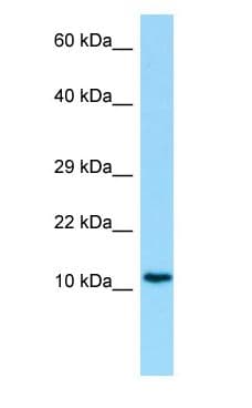 MYDGF / SF20 Antibody (aa67-116)