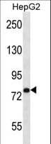 USP45 Antibody (aa309-338)