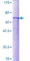 Human ENO2 / NSE Protein (Recombinant GST)