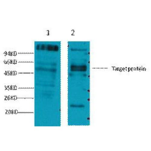 FCER2 / CD23 Antibody (clone 10H2)