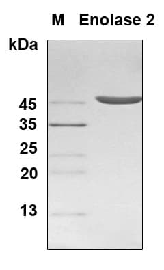 Human ENO2 / NSE Protein (Recombinant 6His, N-terminus)