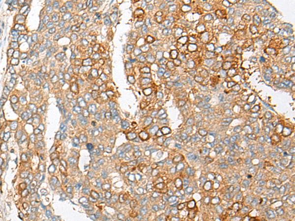 Polyclonal Rabbit anti-Human PCDHGB5 Antibody (IHC)