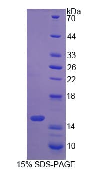 Rat S100A16 Protein (Recombinant His)
