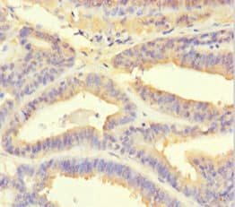 Polyclonal Rabbit anti-Human PSMF1 Antibody (aa1-271)