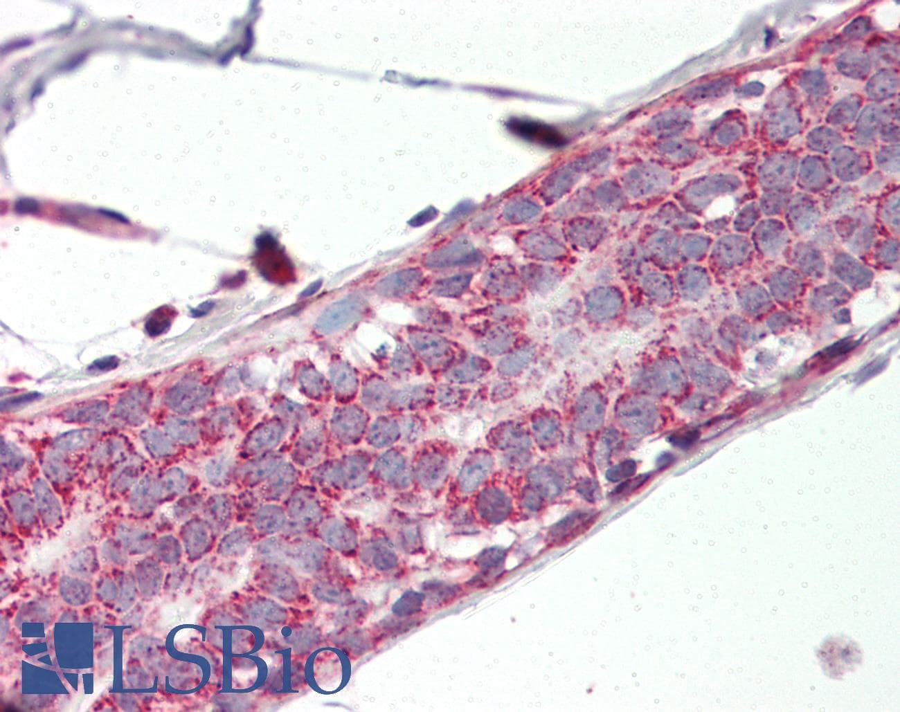 IHC-plus™ Prohibitin 2 / PHB2 Antibody (aa88-299)