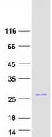 Human BAD Protein (Recombinant Myc-DDK (Flag))
