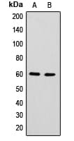 HnRNPLL / HNRPLL Antibody (Internal)