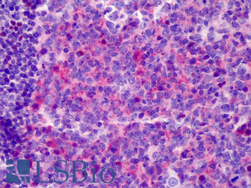 IHC-plus™ NRG1 / Heregulin / Neuregulin Antibody (aa1-50)