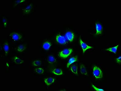 Polyclonal Rabbit anti-Human ITGA2B / CD41 Antibody (aa639-887)