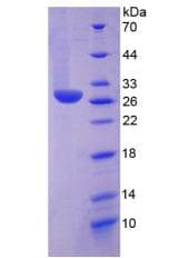 Human HDC / Histidine Decarboxylase Protein (Recombinant His-T7)