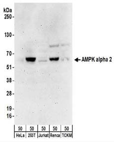 PRKAA2 / AMPK Alpha 2 Antibody