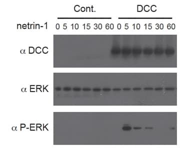 Human NTN1 / Netrin 1 Protein (Recombinant Human IgG1 Fc)