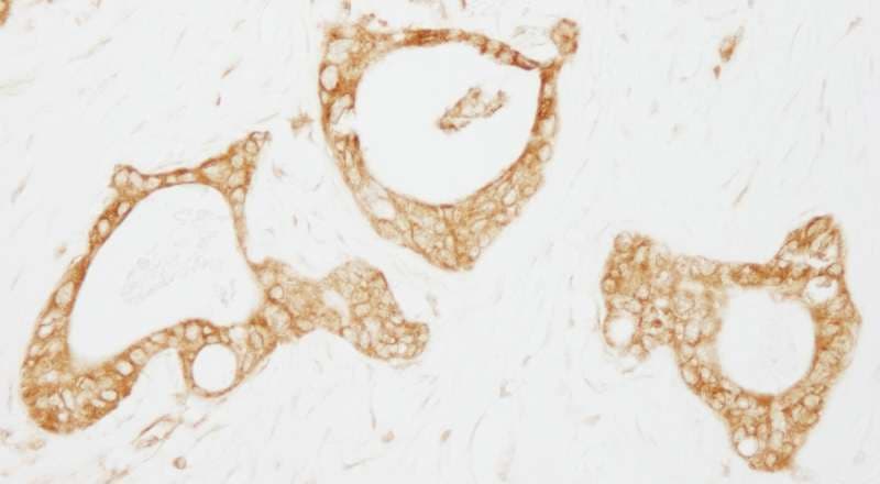 Polyclonal Rabbit anti-Human USP3 / UBP Antibody (aa471-521, IHC)