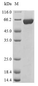 Mouse LYN Protein (Recombinant 10His, N-terminus + Myc, C-terminus)