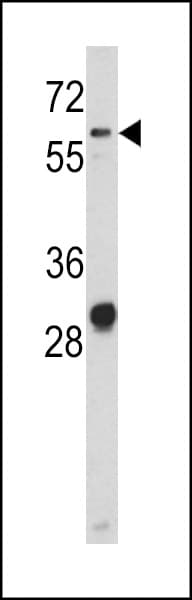 Polyclonal Rabbit anti-Human ALCAM / CD166 Antibody (aa58-87, IHC, WB)