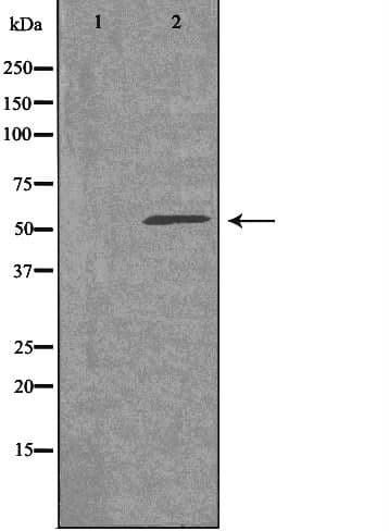 Polyclonal Rabbit anti-Human ADGRE4P / EMR4P Antibody (IF, WB)