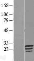 C17orf82 Protein (Over-Expression Lysate Myc-DDK (Flag))
