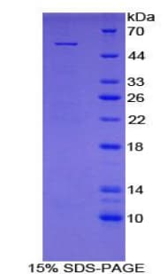 Rat MBL2 / Mannose Binding Protein (Recombinant His-GST)