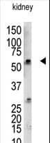 RBCK1 Antibody (aa16-46)