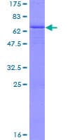 Human EPM2A / Laforin Protein (Recombinant GST)