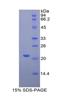 Rat FGL2 Protein (Recombinant His)