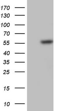 PLAU / Urokinase / uPA Antibody (aa107-379, clone OTI6H1)