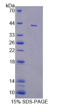 Pig CCL8 / MCP2 Protein (Recombinant His-GST)