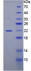 Rat GREM1 / Gremlin-1 Protein (Recombinant His-T7)