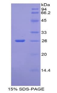 Rat CREBBP / CREB Binding Protein (Recombinant His)