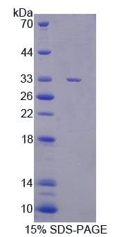 Mouse CASC5 Protein (Recombinant His, N-Terminal)