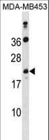 ATP5S Antibody (aa36-64)