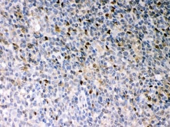 SPI1 / PU.1 Antibody