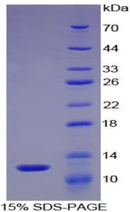 Mouse CXCL5 Protein (Recombinant His-T7)