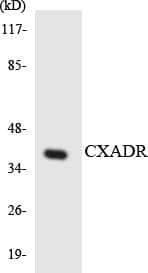 Polyclonal Rabbit anti-Human CXADR Antibody (aa38-87, WB)
