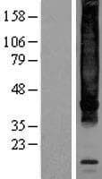 TACR1 / NK1R Protein (Over-Expression Lysate Myc-DDK (Flag))