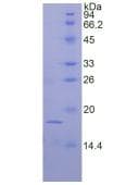 Mouse FGF1 / Acidic FGF Protein (Recombinant His, N-Terminal)