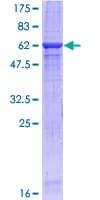 Human ERBB3 / HER3 Protein (Recombinant GST)