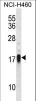 Polyclonal Rabbit anti-Human CD27L / CD70 Antibody (aa72-101, IHC, WB)