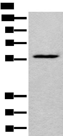 LDHD / Lactate Dehydrogenase D Antibody