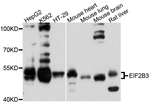 Polyclonal Rabbit anti-Human EIF2B3 Antibody (WB)