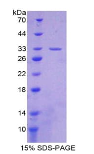 Rat AGRN / Agrin Protein (Recombinant His-T7)