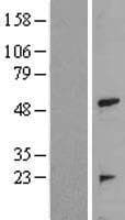 TRAIP / TRIP Protein (Over-Expression Lysate Myc-DDK (Flag))