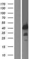 ZNF365 Protein (Over-Expression Lysate Myc-DDK (Flag))