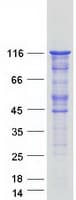 Human LIPE / HSL Protein (Recombinant Myc-DDK (Flag))