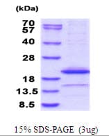 Mouse IL1A / IL-1 Alpha Protein (Recombinant His)