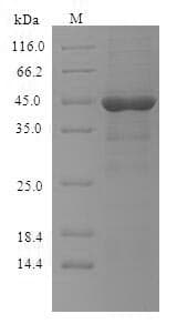 Human FcERI / Fc Epsilon RI Protein (Recombinant 6His, N-terminus)
