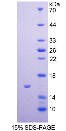 Human GRPR Protein (Recombinant His-T7)