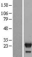 NXT2 Protein (Over-Expression Lysate Myc-DDK (Flag))